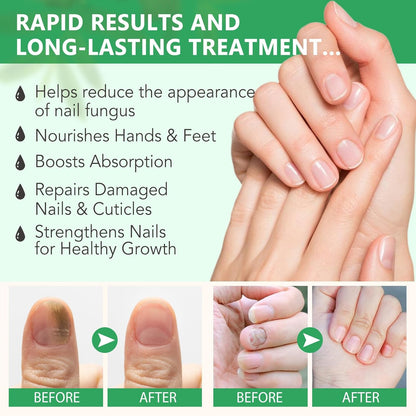 7 Day Nail Treatment