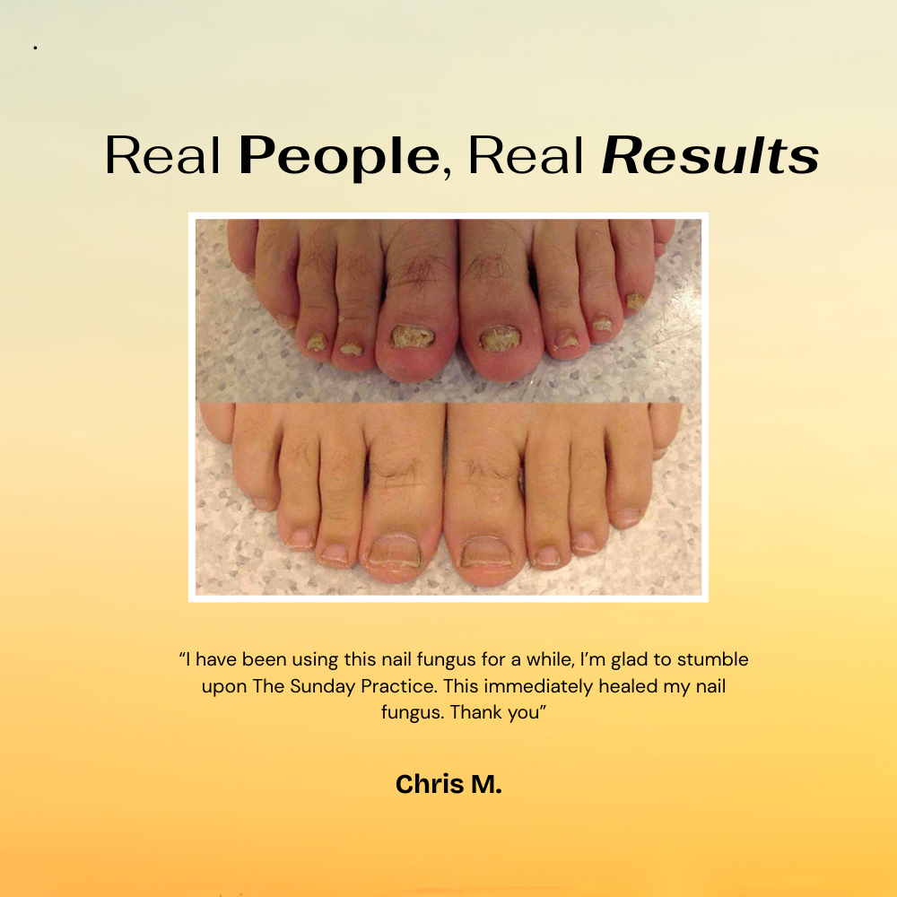 GoldenRoot™ Nail Treatment