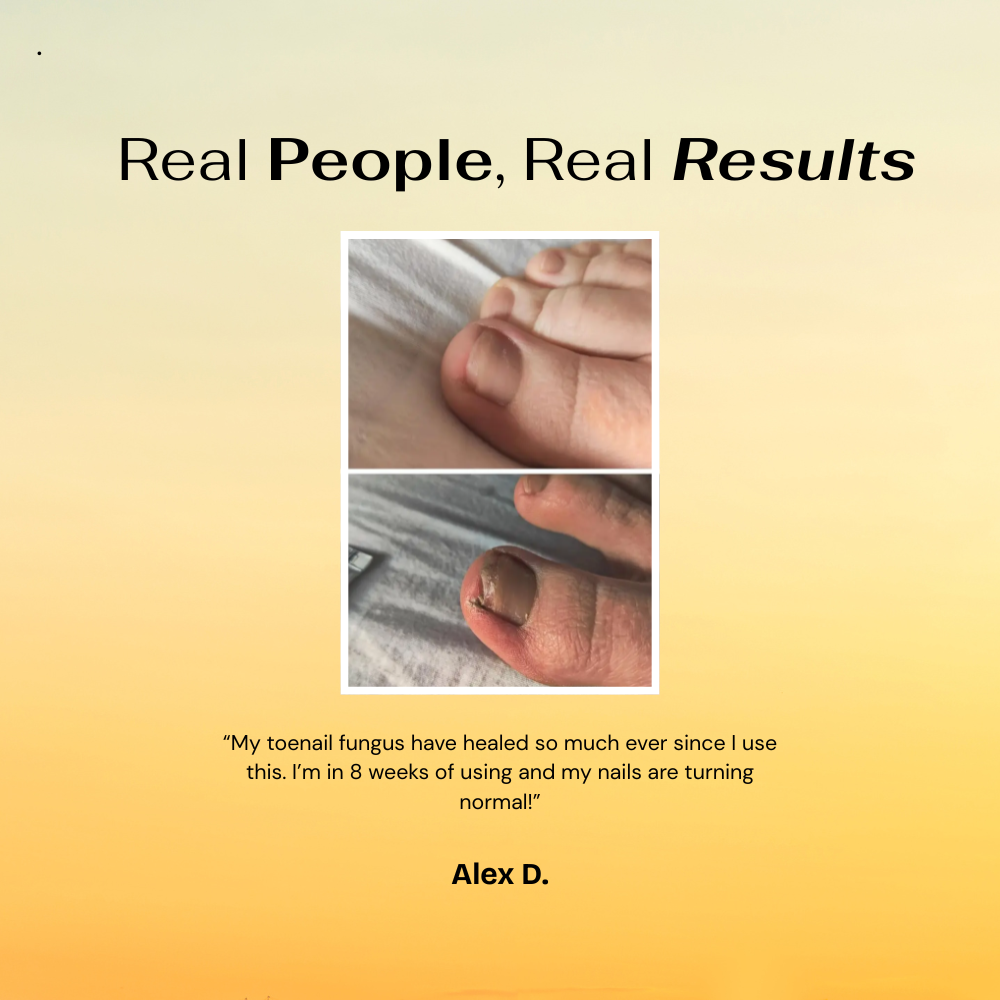 GoldenRoot™ Nail Treatment