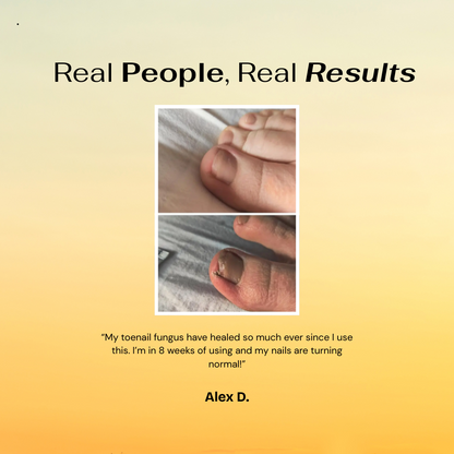 GoldenRoot™ Nail Treatment